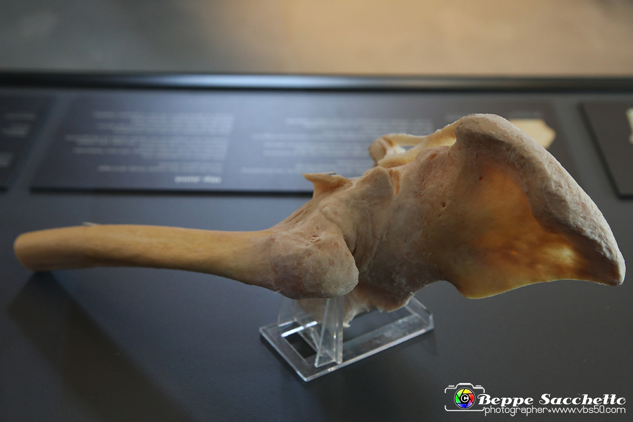 VBS_3062 - Articolazione dell'anca - Mostra Body Worlds.jpg